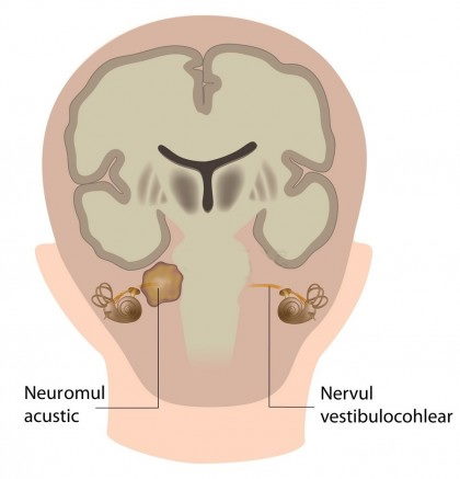 vestibular